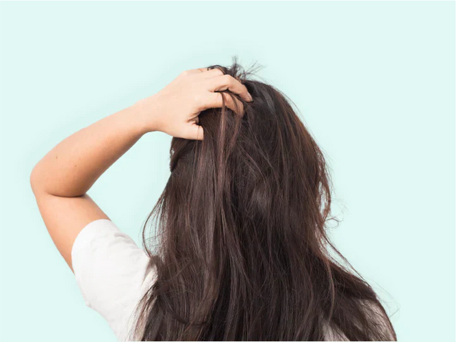 Jeukende hoofdhuid: alle mogelijke oorzaken op een rij en 15 tips om het te verlichten