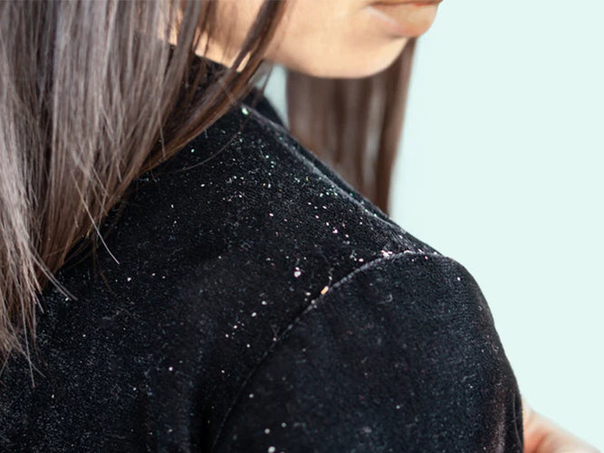 Pityriasis capitis | Dandruff