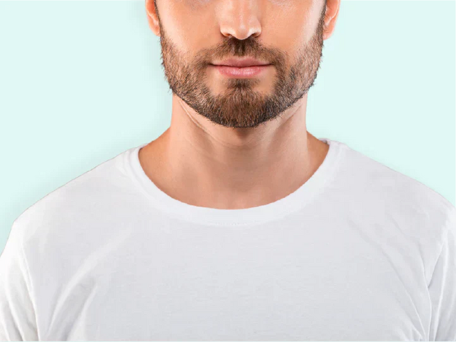 Why Can't I Grow a Beard?