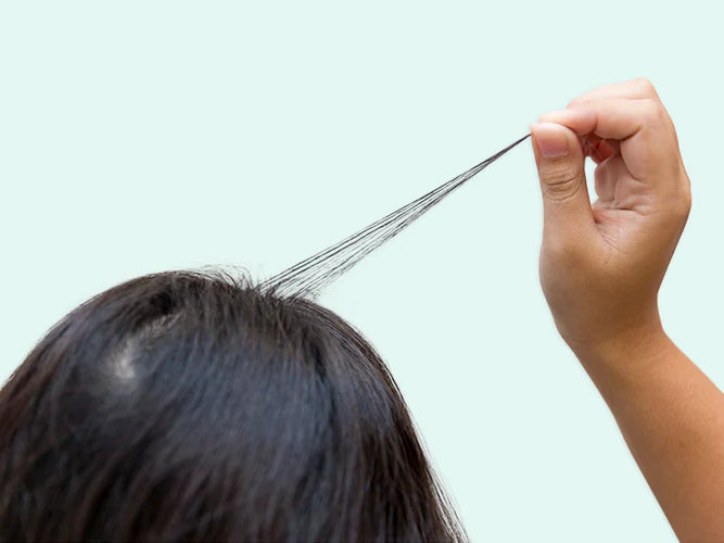 Hair pulling disorder | Trichotillomania