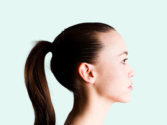 What is Traction Alopecia?