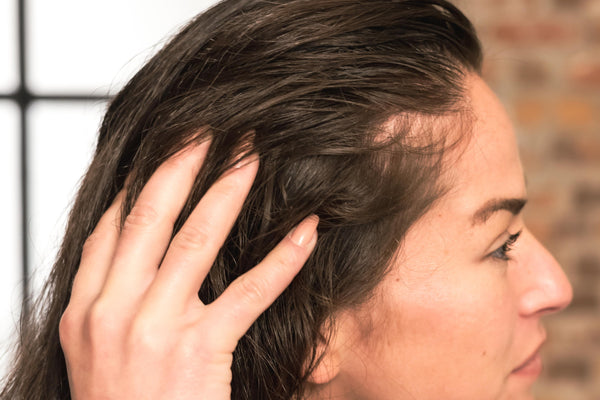 Yeast infection on scalp