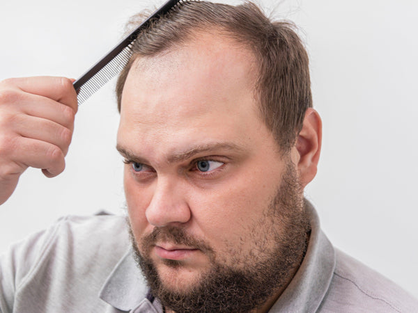 Man combing receding hairline 