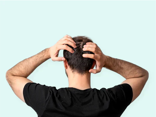 Woman touching her scalp because of an itchy feeling