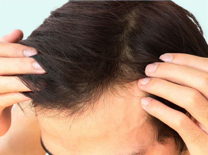 Weetjes over haar: onderscheid tussen feiten en mythen