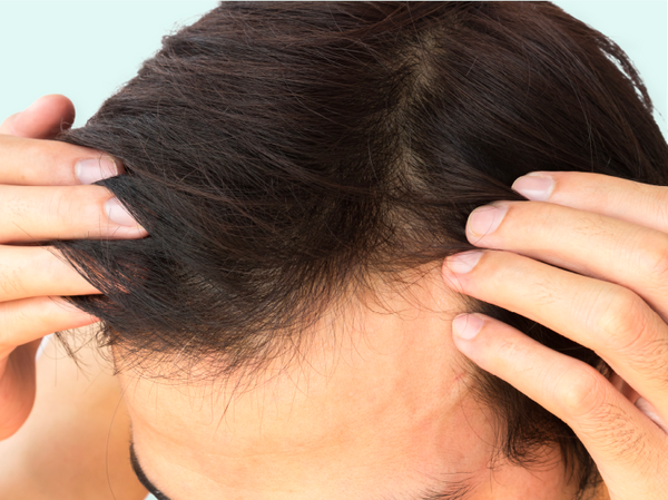 Common Hair Loss & Hair Growth Facts | Myths