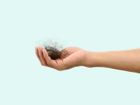 Why isn't my hair loss improving after using Ferritin?