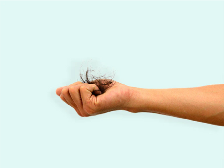 Haaruitval na bleken