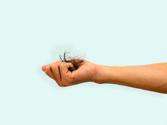 Haaruitval na bleken