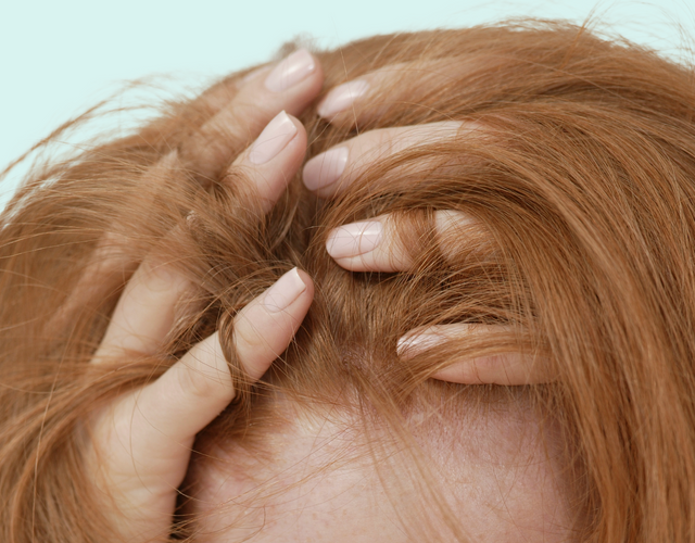 Hair loss causes