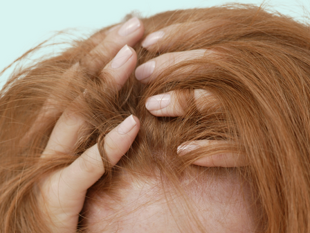 Hair loss causes