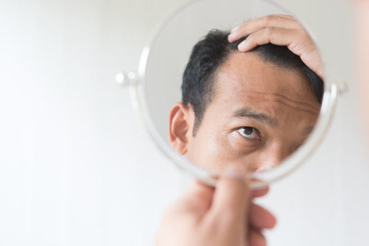 Man with receding hairline looking in the mirror