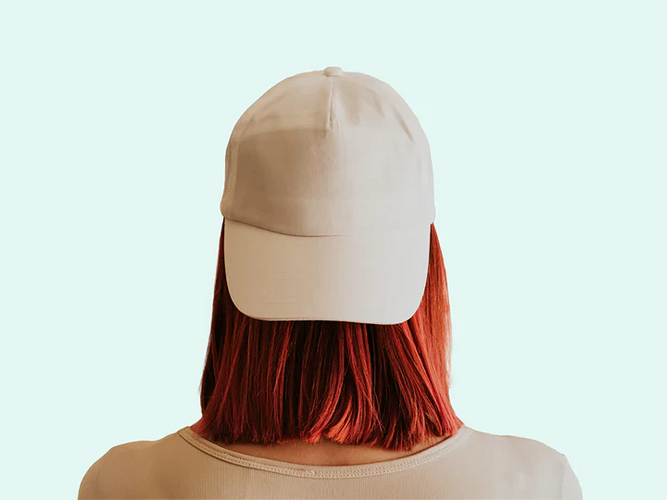 Does wearing a hat cause baldness?