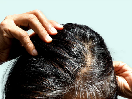 Grey hair: causes, contributing factors and what you can do against it