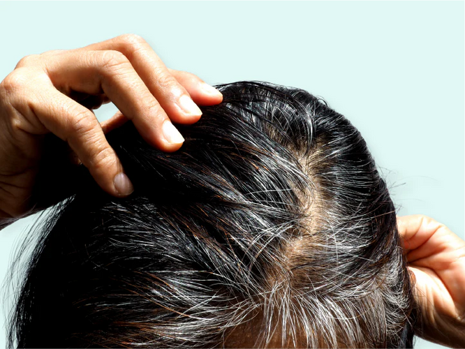 How to get rid of grey hair?