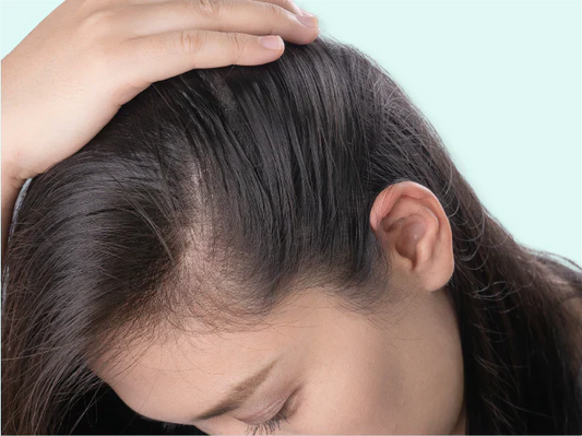 Natural Home Remedies for Hair Growth and Thickness