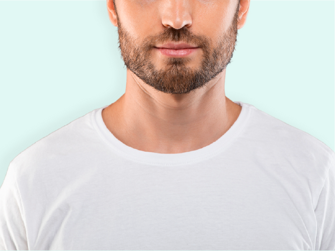 Why Can't I Grow a Beard?