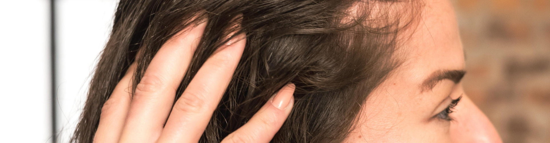 Hair thinning at temples female