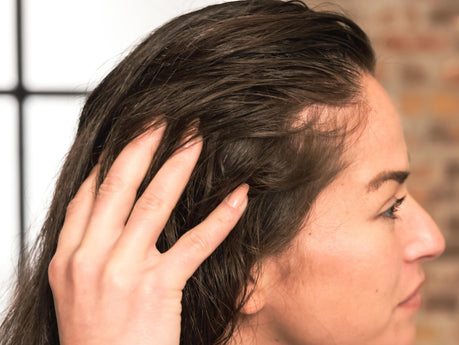 Waarom krijgen vrouwen dunner wordend haar bij de slapen?