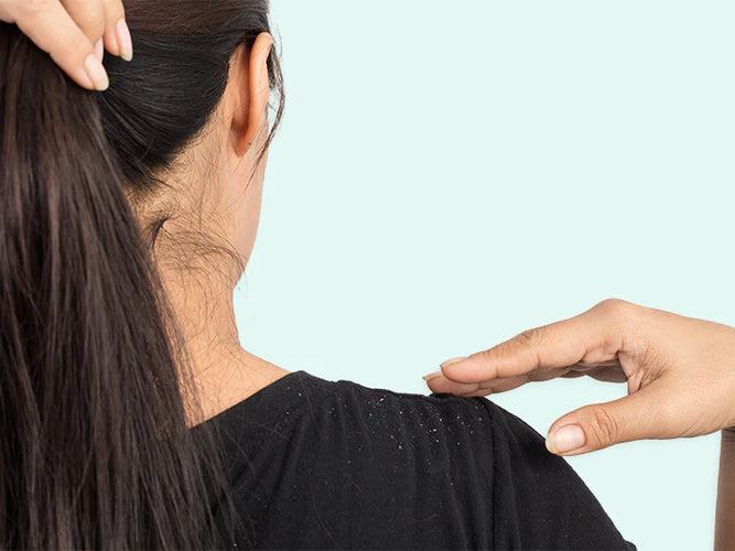 The most common causes of flakes on the scalp