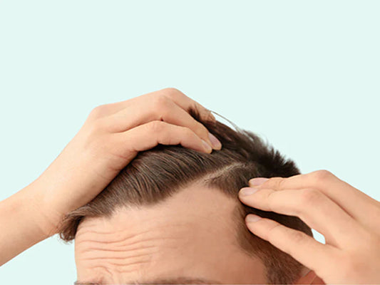 Why hair loss occurs in men and what you can do about it
