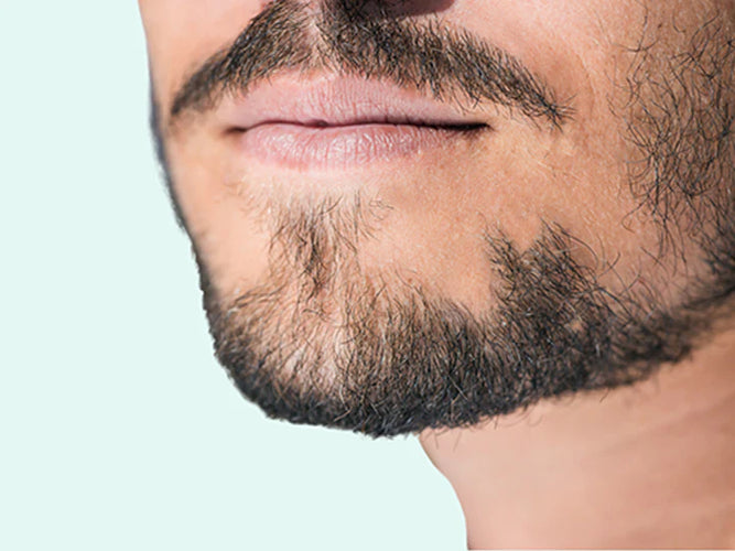 Patchy Beard Growth