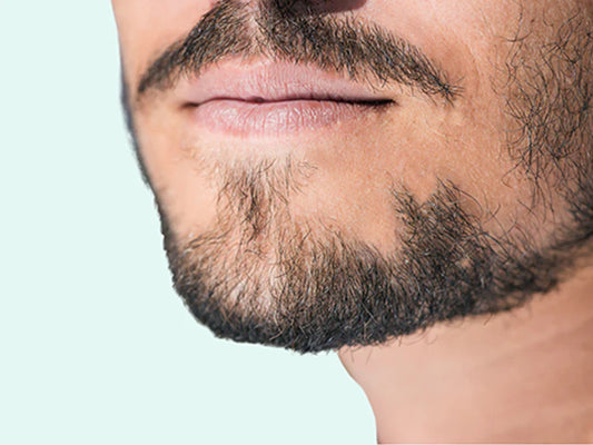 Patchy Beard Growth