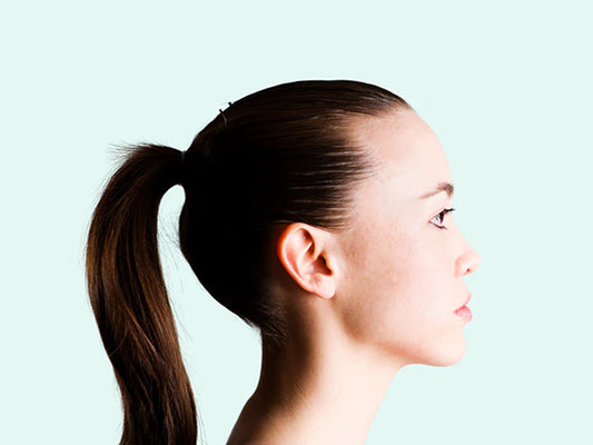 What is Traction Alopecia?