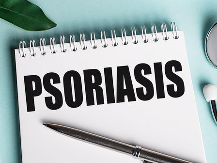 What Causes Psoriasis and What are The Symptoms?