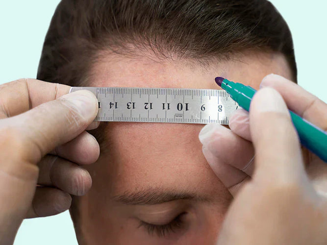 Hoe snel groeit haar? Ontdek wat normaal is en wat je kunt verwachten