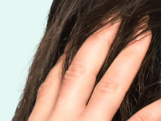Yeast infection on scalp