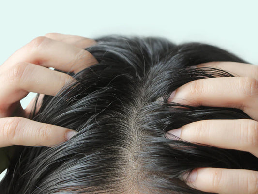 Person with greasy hair