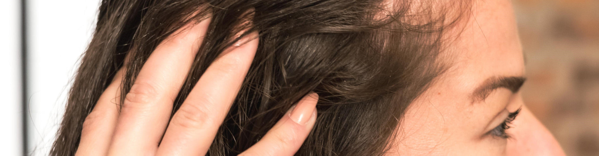 Yeast infection on scalp
