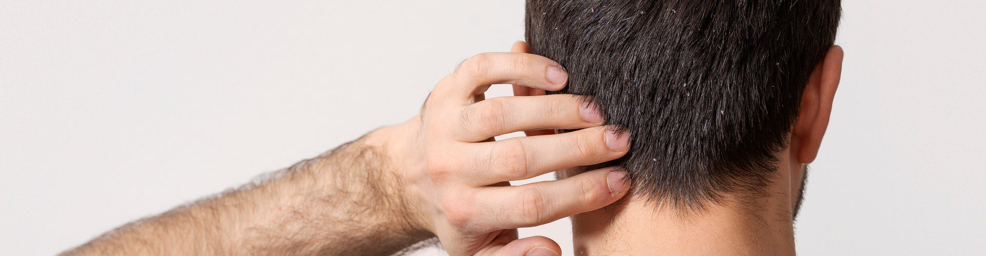 Inflammation and redness of the scalp