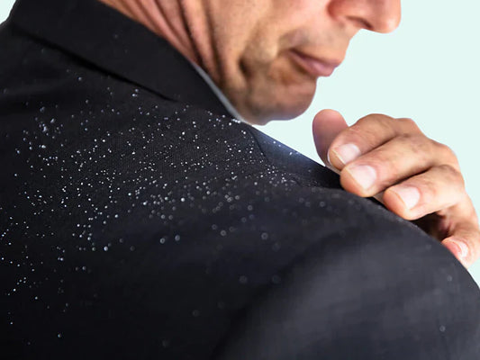 Man met schilfers van hoofdhuid op zijn jasje