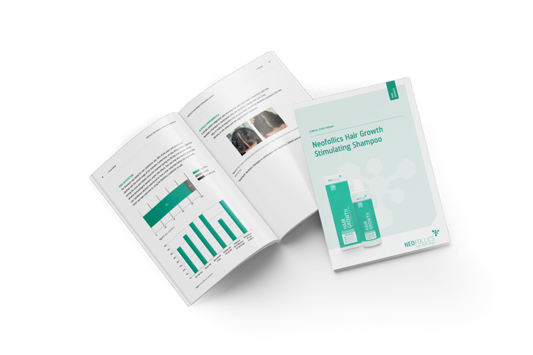 Klinische onderzoeksresultaten Neofollics Hair Growth Stimulating Shampoo