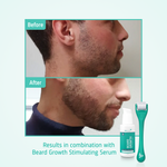 Beard Growth Enhancing Roller before after