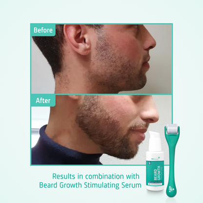 Beard Growth Enhancing Roller before after