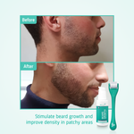 Beard Growth kit before after