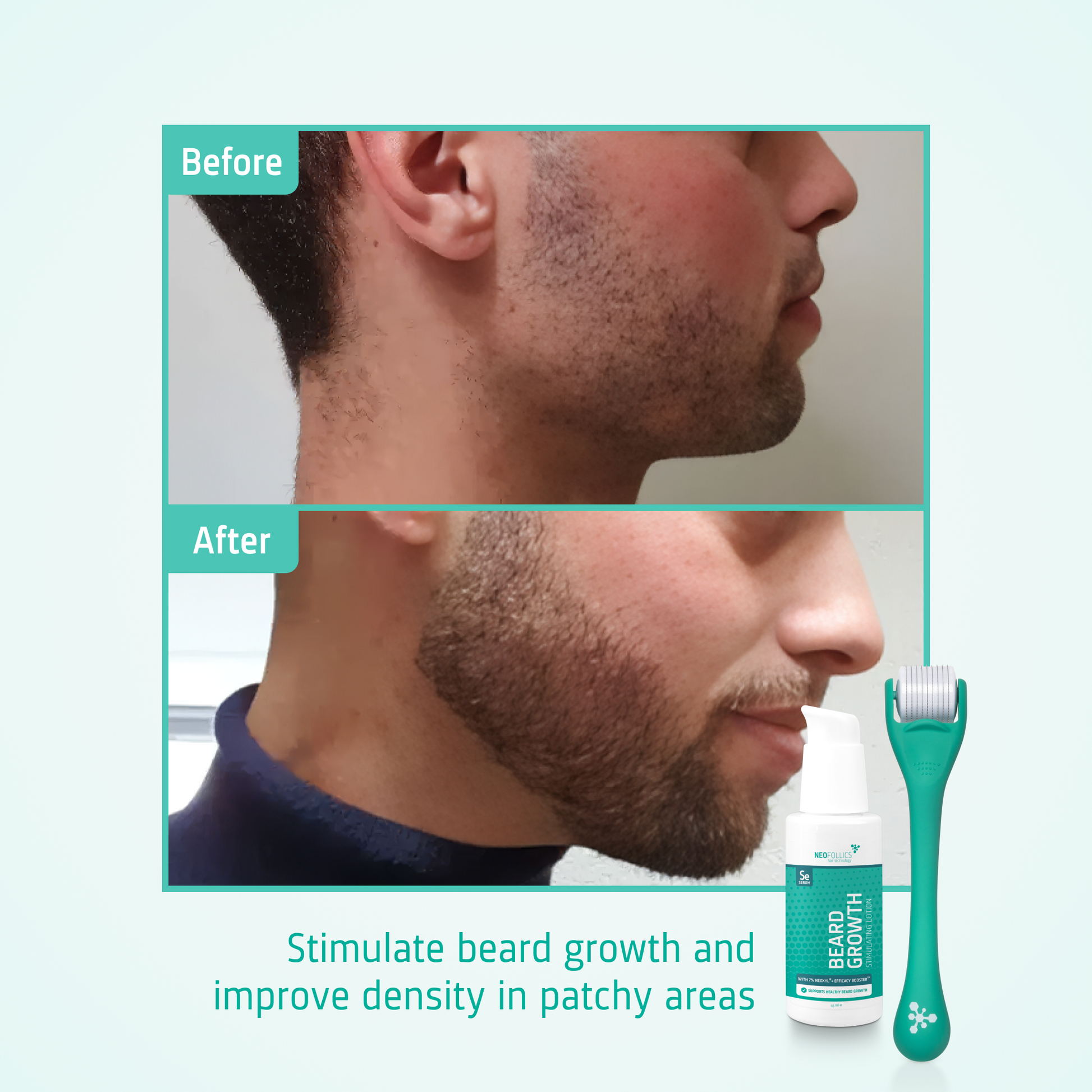 Beard Growth kit before after