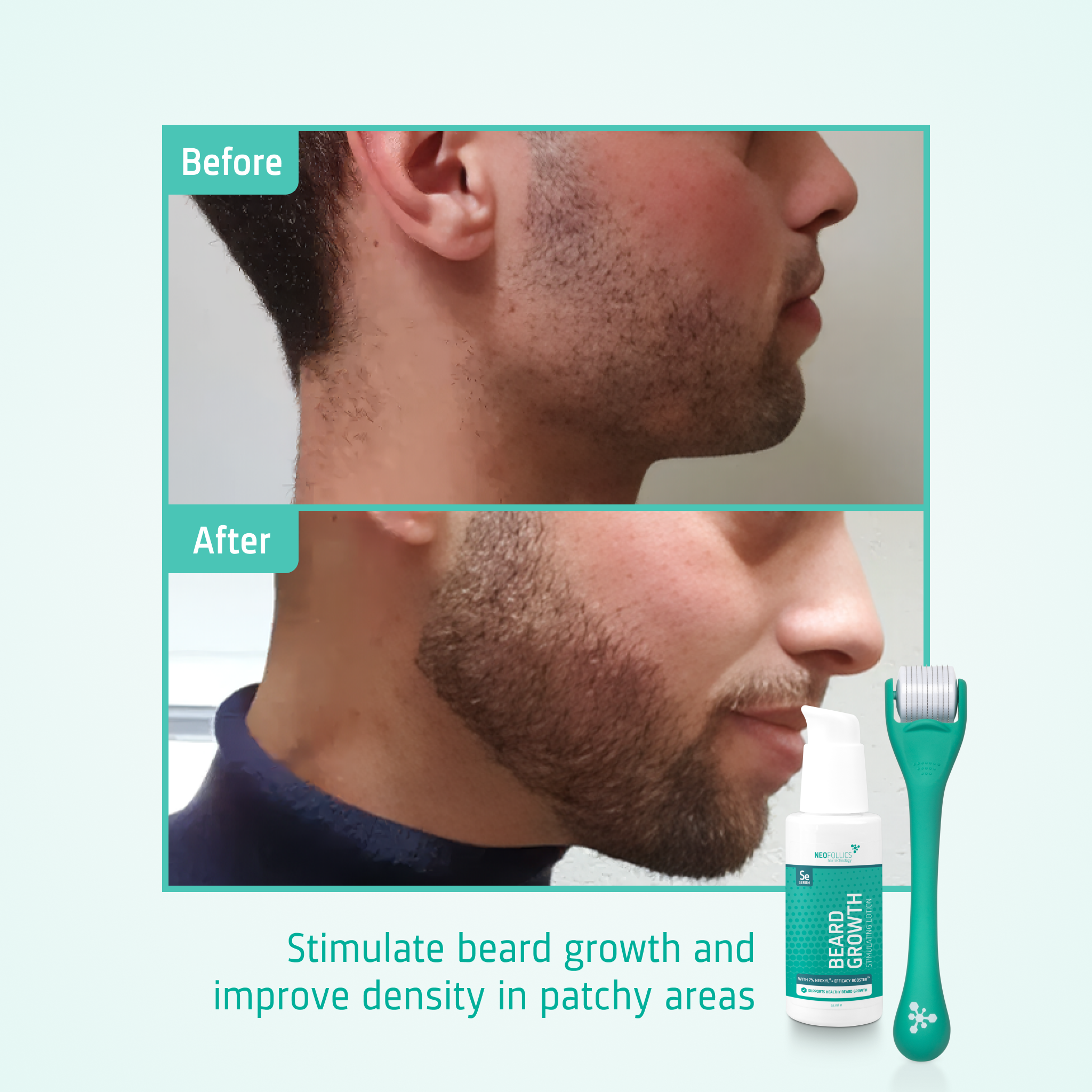 Beard Growth kit before after