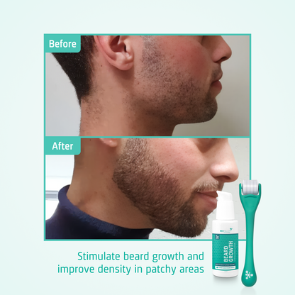 Beard Growth kit before after