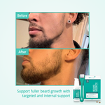 Beard Growth routine before after