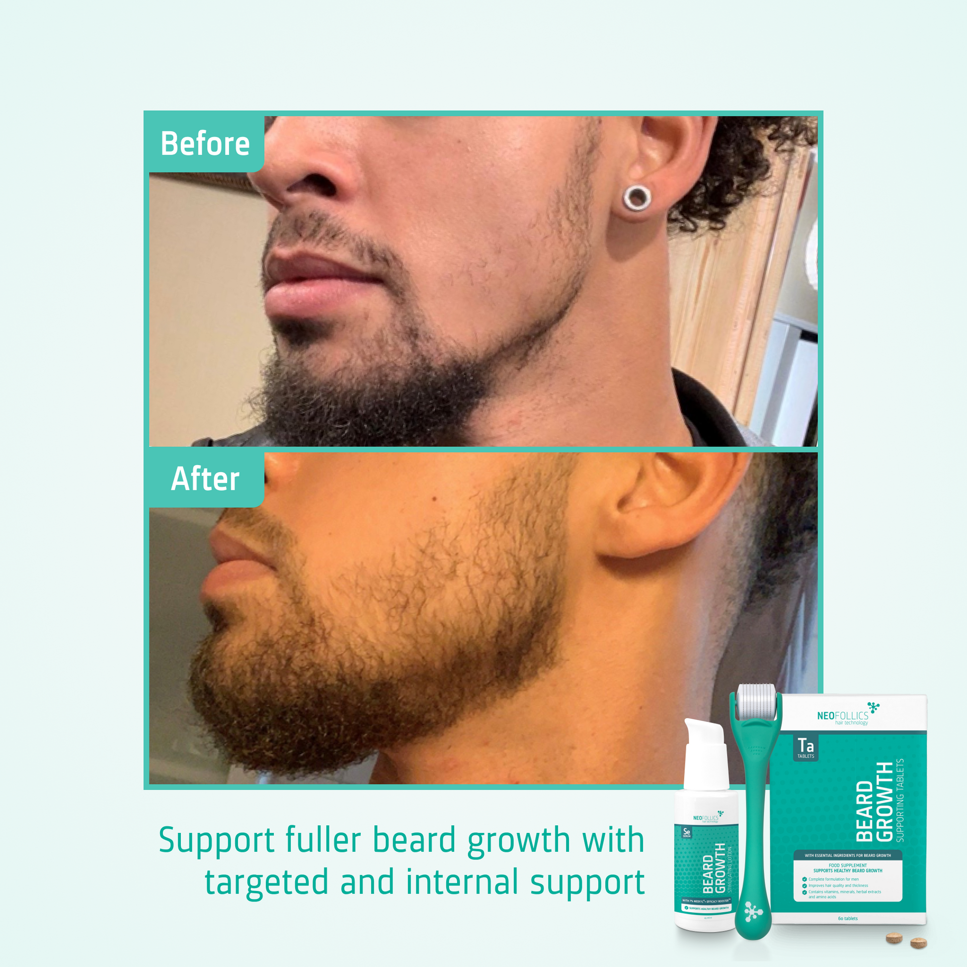 l carnitine l tartrate for beard growth Beard Growth Supporting Tablets main image 0