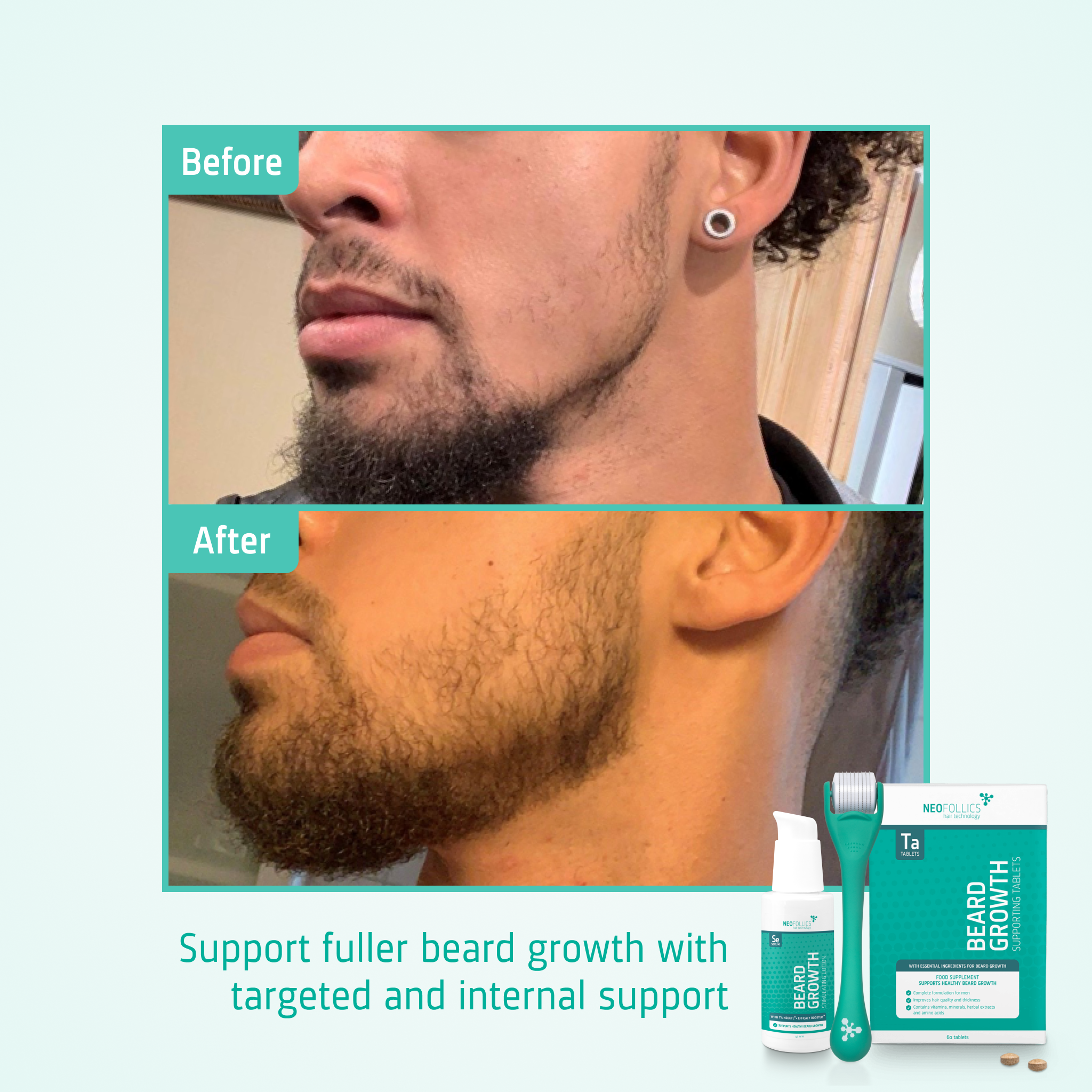 Beard Growth routine before after