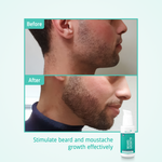 Beard Growth Stimulating Serum before after