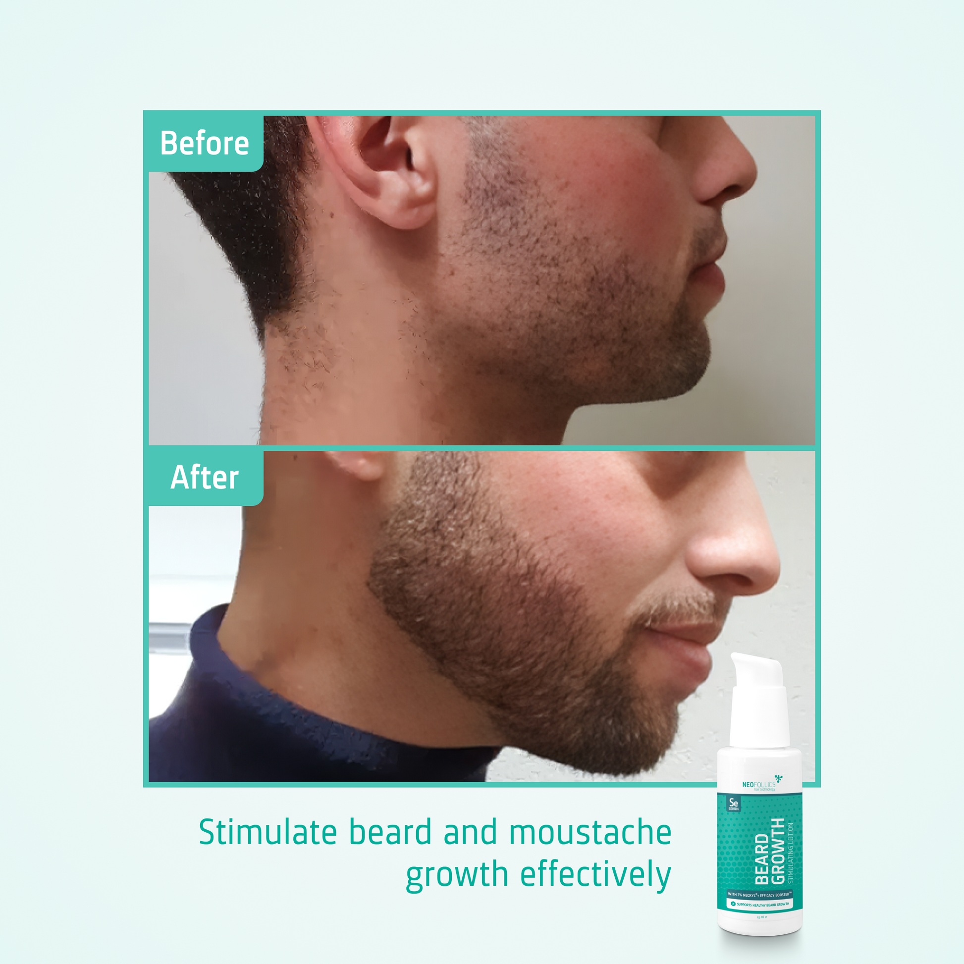 Beard Growth Stimulating Serum before after
