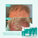 Hair Growth Advanced hair loss routine before after
