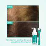 Hair Growth kit before after