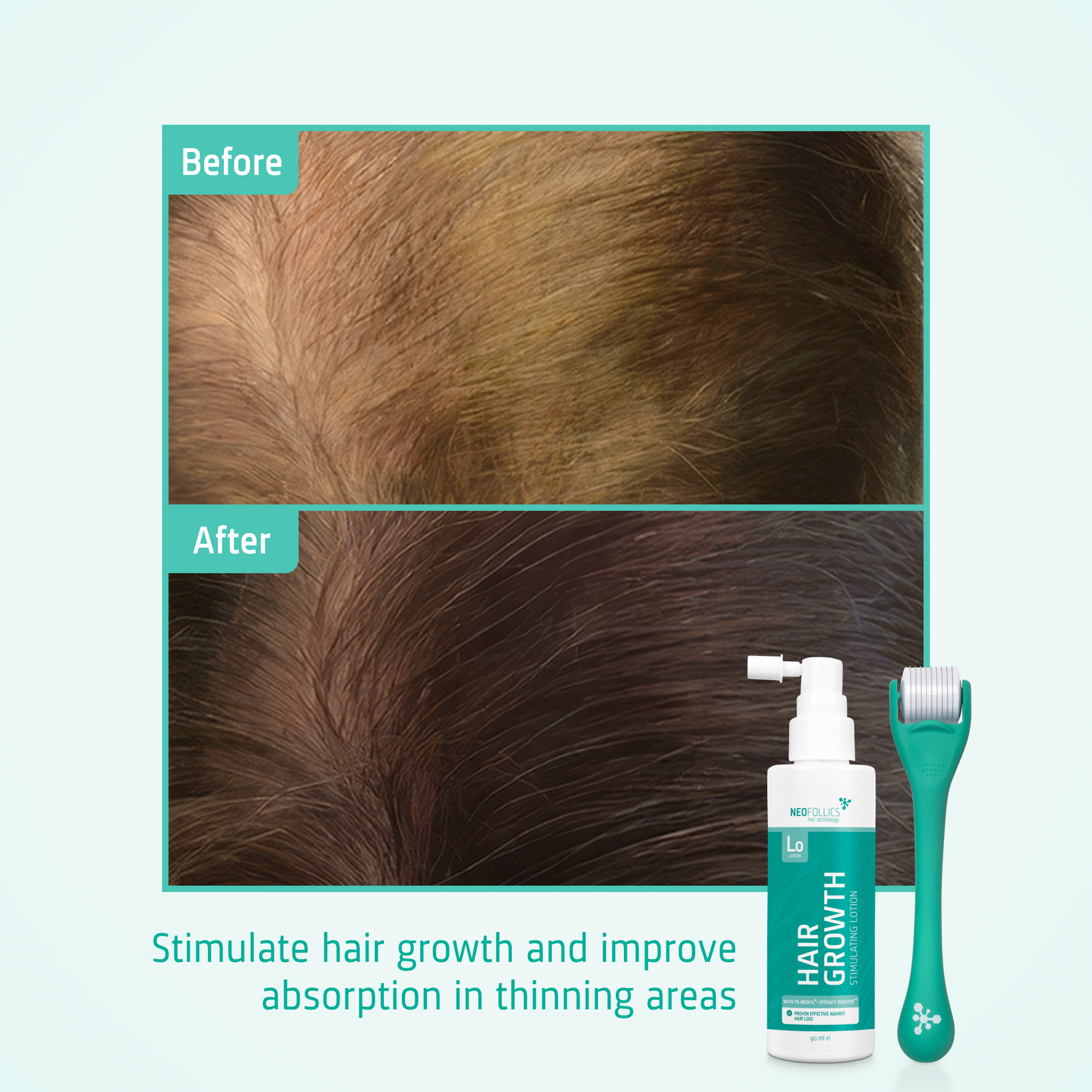 Hair Growth kit before after